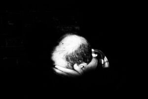 how to deal with hair loss and reverse balding for men
